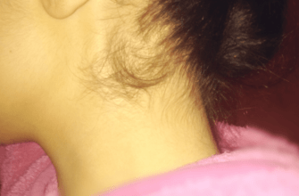 растут волосы на шее