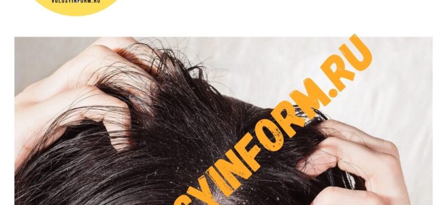 Перхоть зимой