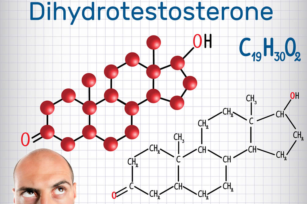 дигидротестостерон